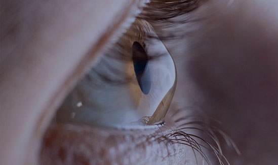 Tratamento do Ceratocone Tratamento do Ceratocone