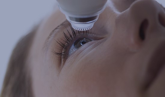 Cirurgia Refrativa a Laser Cirurgia Refrativa a Laser