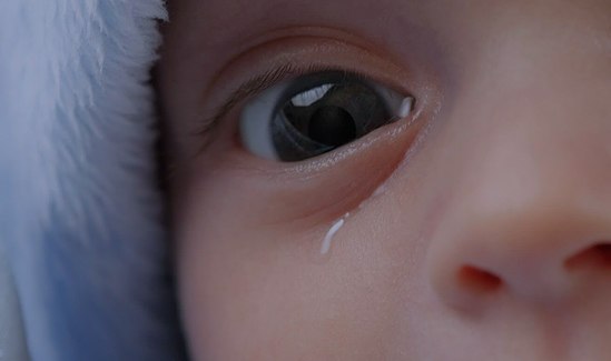 Cirurgia das Vias Lacrimais Cirurgia das Vias Lacrimais