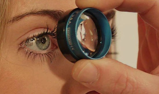 Gonioscopia Gonioscopia